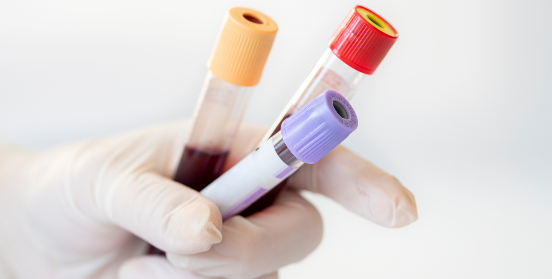 TruCheck Intelli Multi-Cancer Screening Test